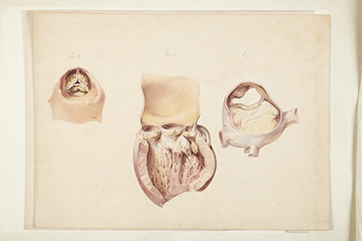 PR15235a Ostium aorta of Dr Monsey JCH 2021.jpg; PR15235a; ;